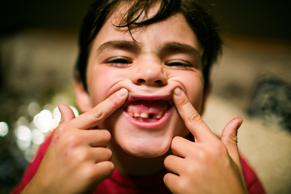 boy shows off missing tooth - Documentary Family Photography