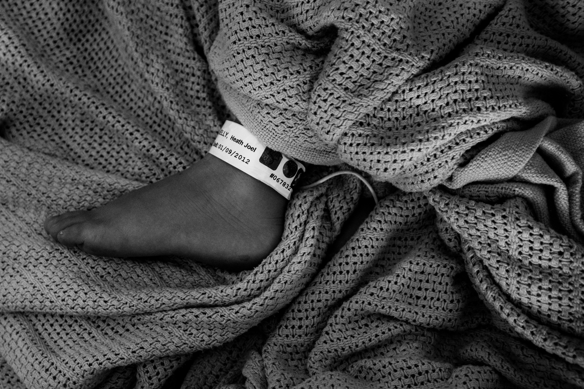 child's foot with hospital anklet - Documentary Family Photography