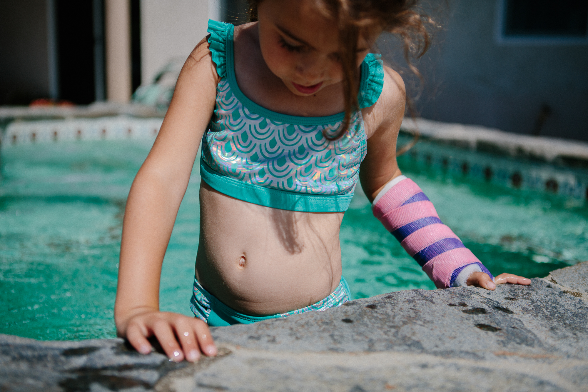 girl with cast on pool - documentary family photography