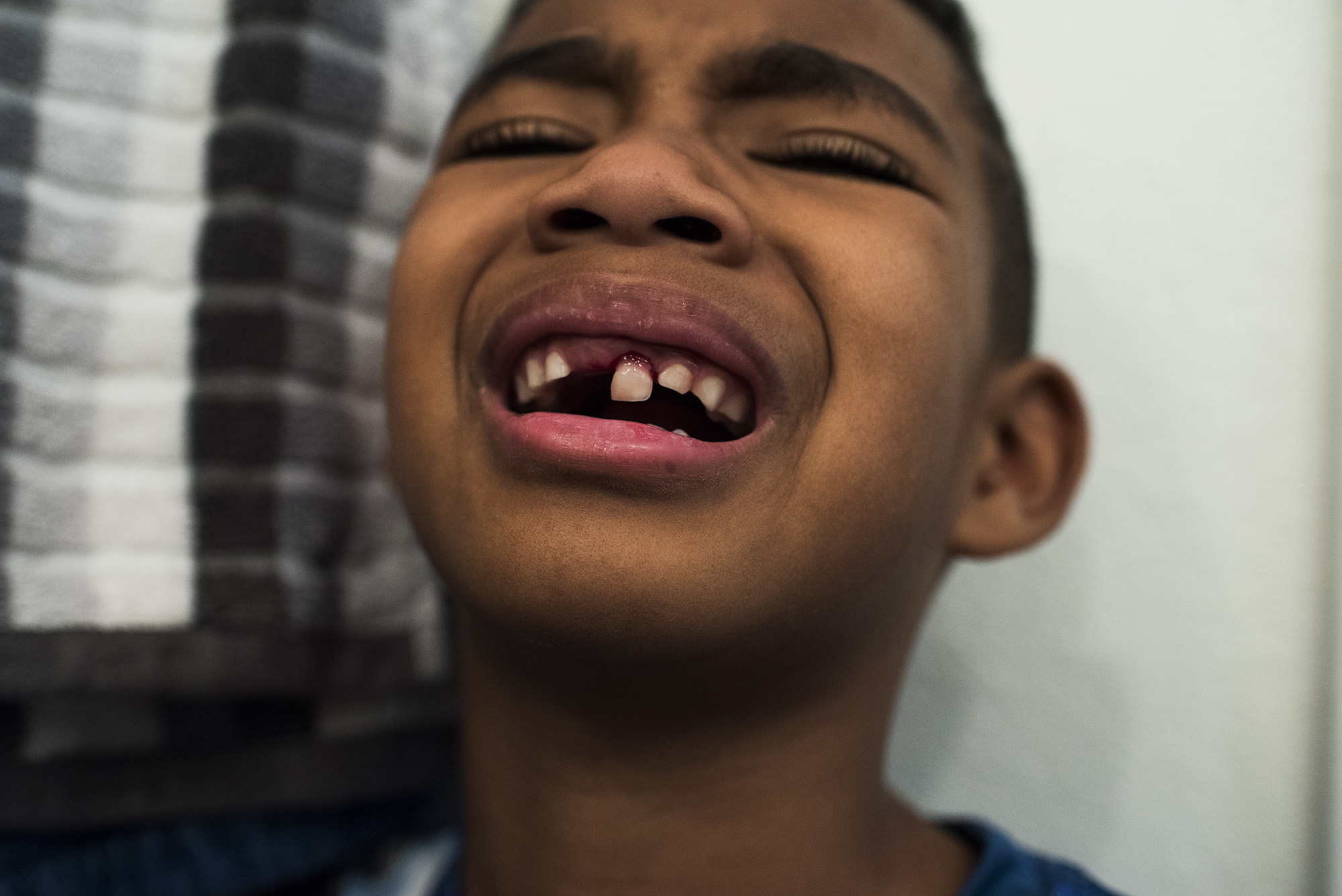 boy missing front tooth - documentary family photography